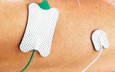 O que é Eletroneuromiografia?