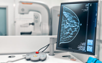 Por dentro de um exame de mamografia